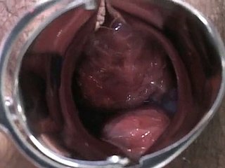 Signora incinta giapponese viene esaminato e succhia lollicock del pier